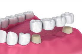 BEST CARE DENTAL CLINIC THACHAMPARA