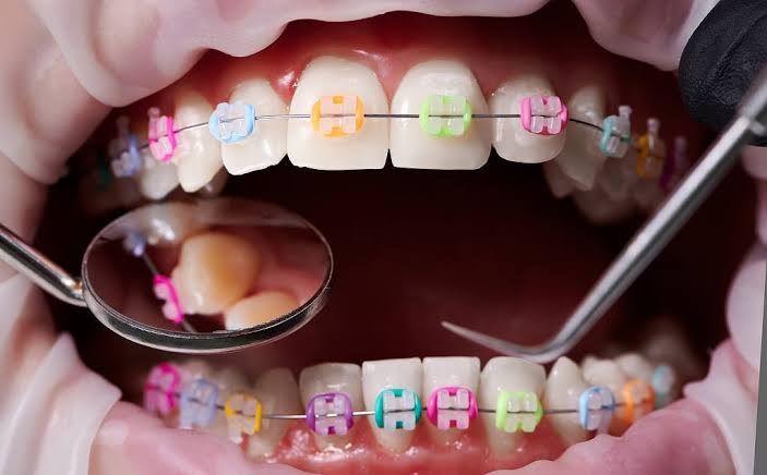 BEST CARE DENTAL CLINIC THACHAMPARA