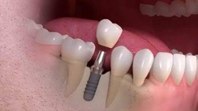 BEST CARE DENTAL CLINIC THACHAMPARA